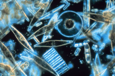 Diatoms Viewed Through Microscope