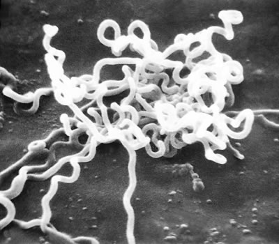 Bacteria that Cause Syphilis Treponema pallidum