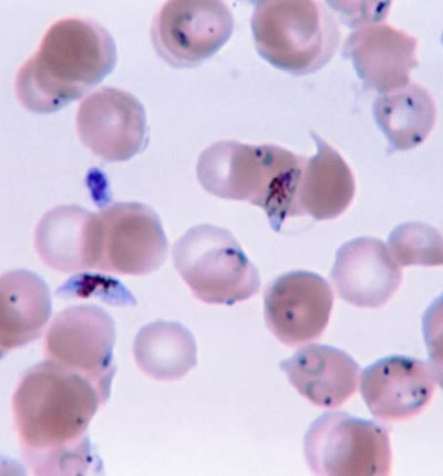 Pathogen that Causes Malaria Plasmodium